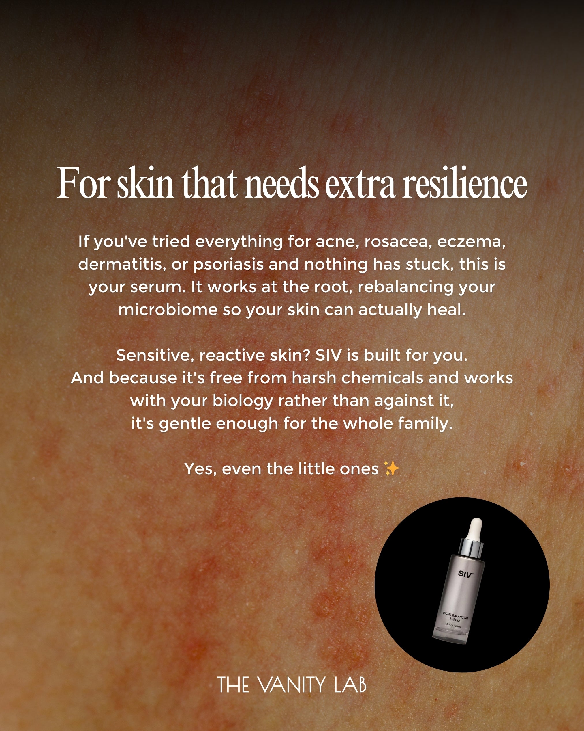 SIV Biome Balancing Serum