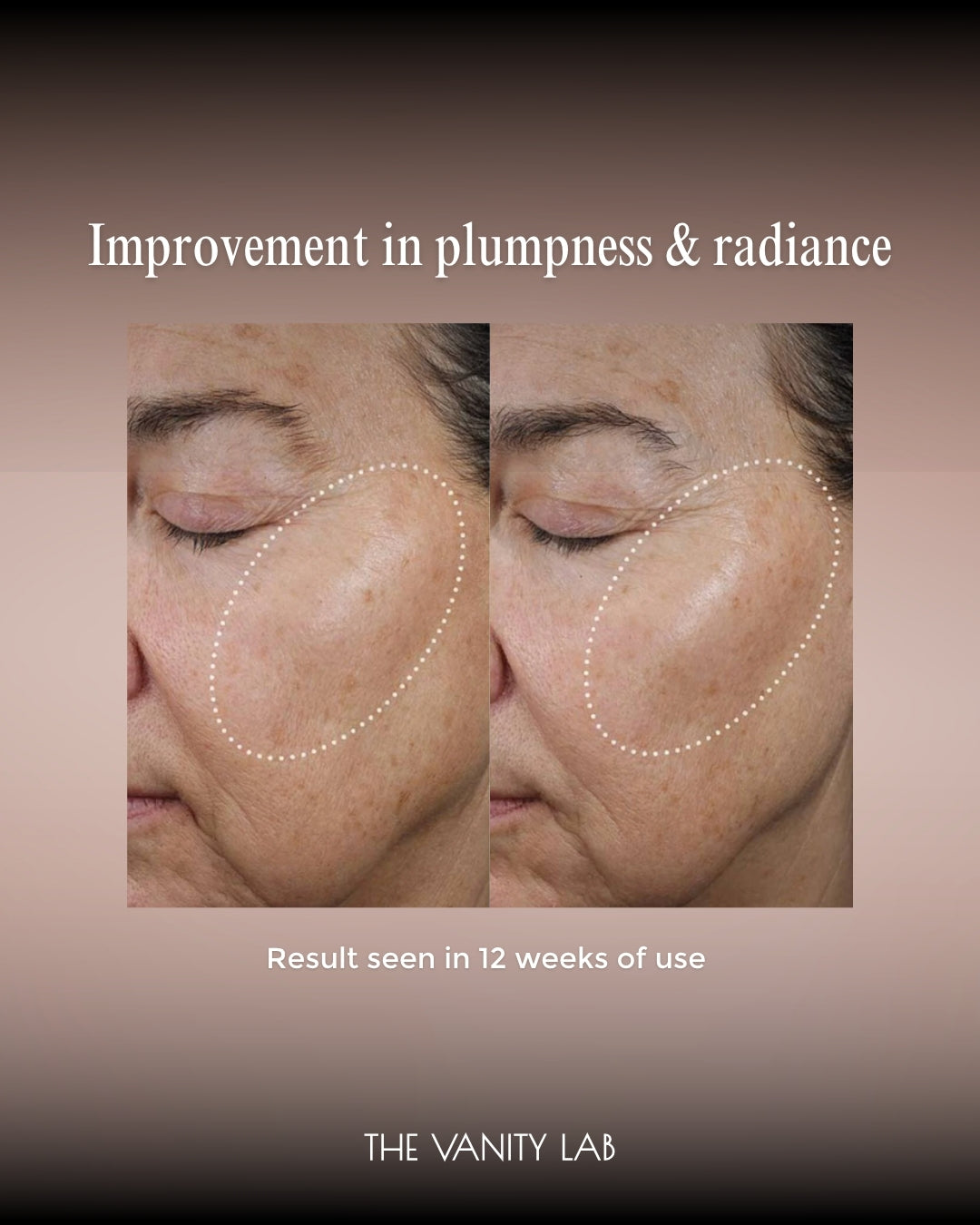 SkinBetter Ampra Volumizing Macro HA Serum